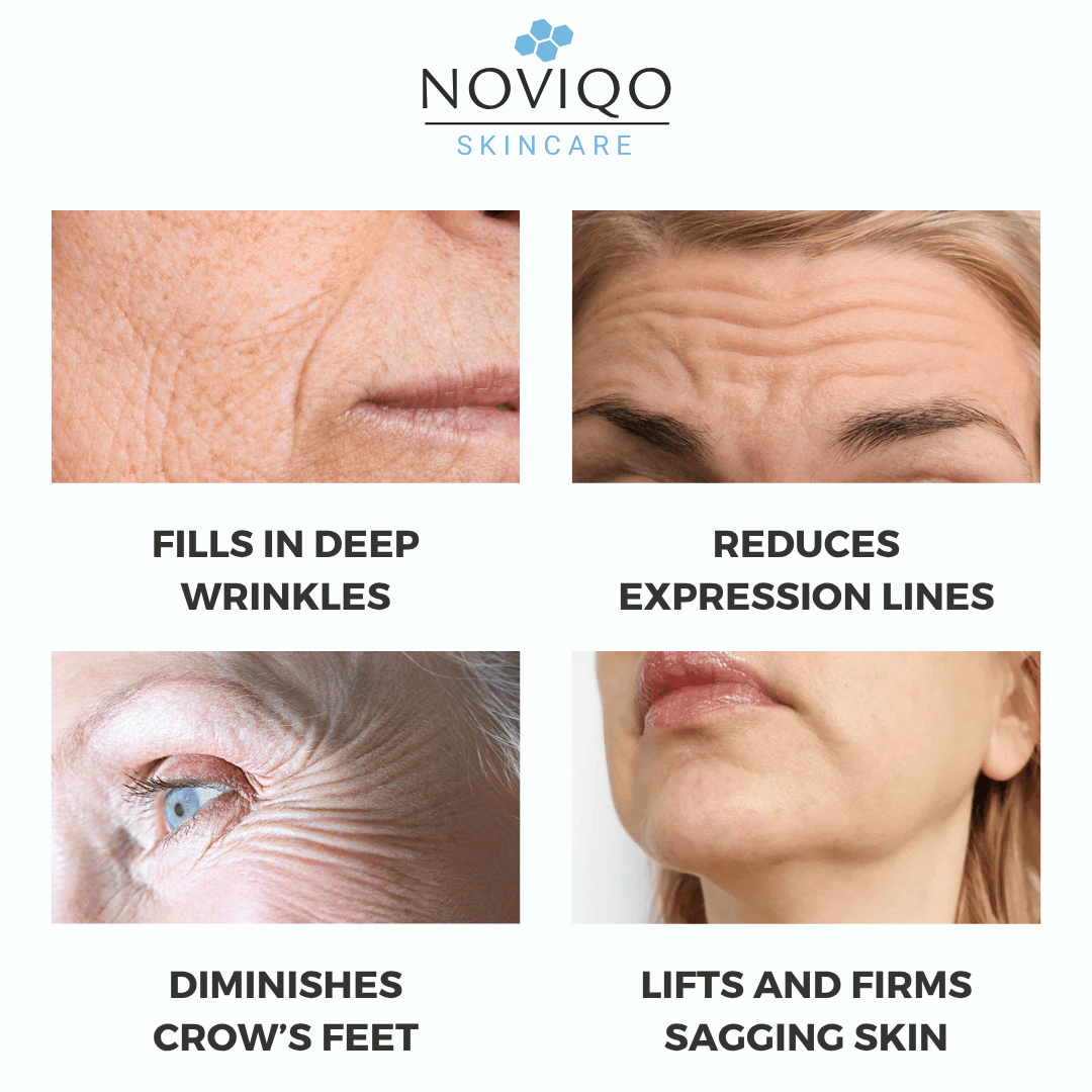 Noviqo - Female Noviqo - Female
