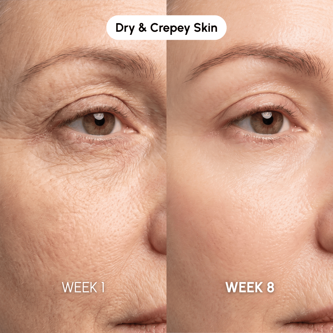 Noviqo™ – Eye Firming & Repair System