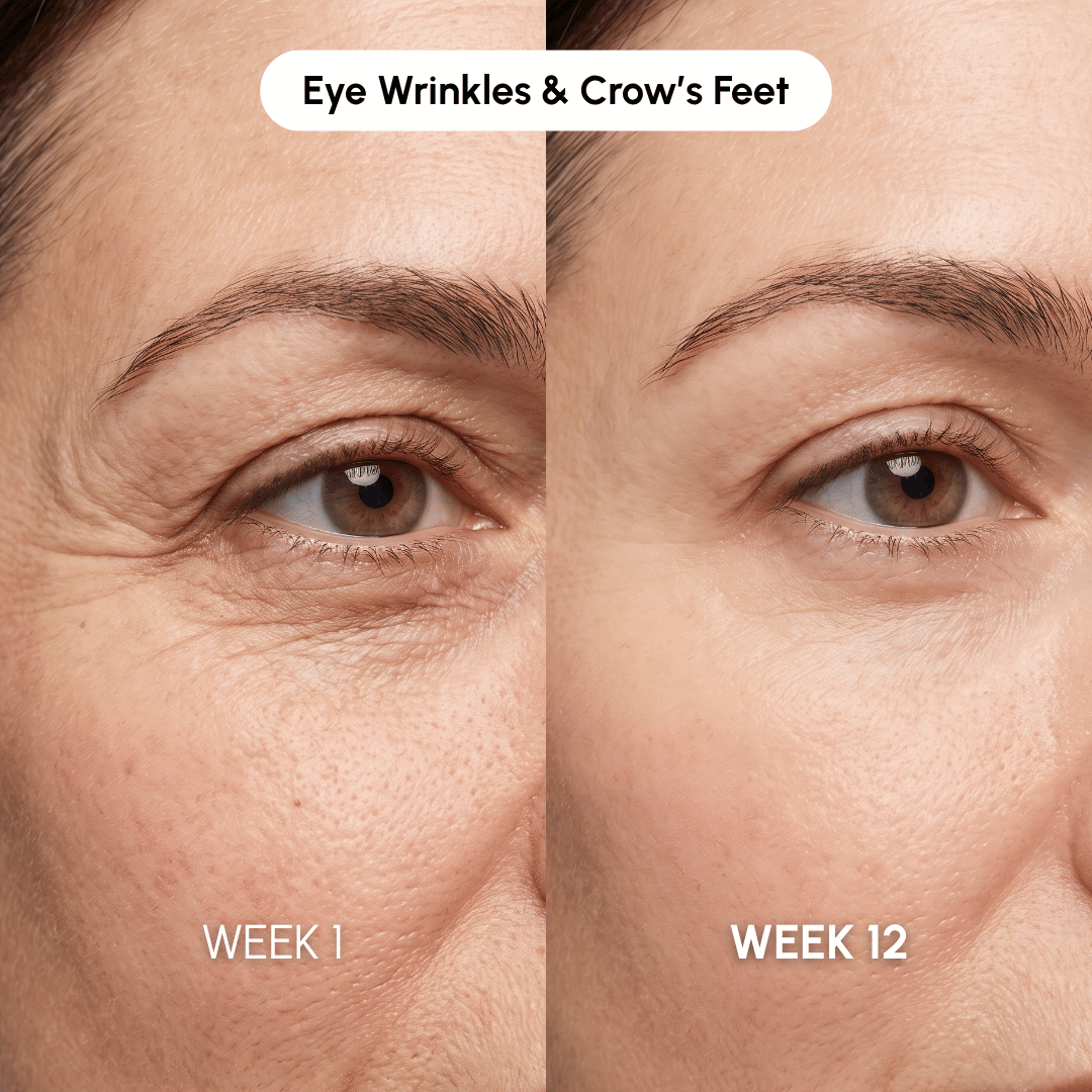 Noviqo™ – Eye Firming & Repair System